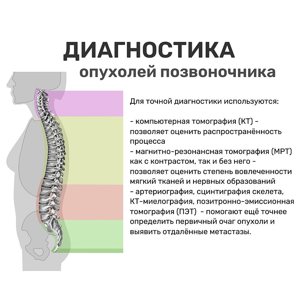 Опухоли позвоночника классификация. Отек позвоночника после операции