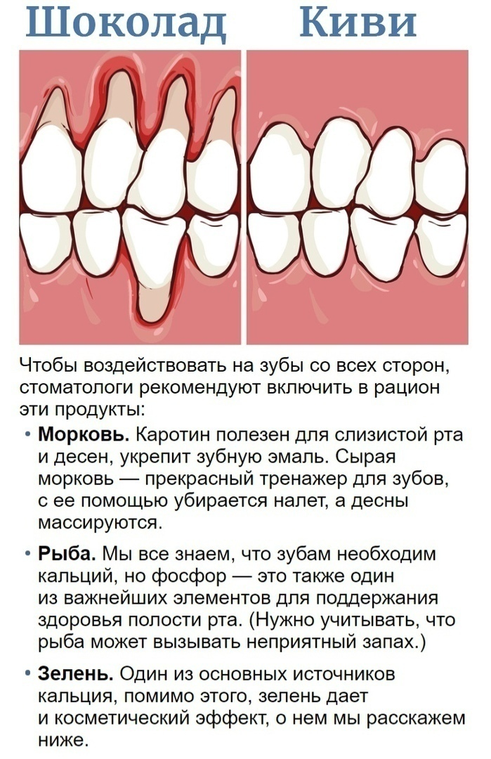 Как быстро снять чувствительность зубов Реминерализация и фторирование зубов