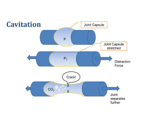 Наглядно изображен сустав: 1 - его статичное положение, 2 - движение (давление в суставе снижается из-за растягивания), 3 - пузырики с углекислым газом схлопывается, мы слышим щелчок