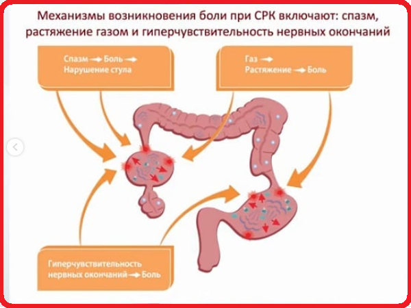 почему возникают сильные боли