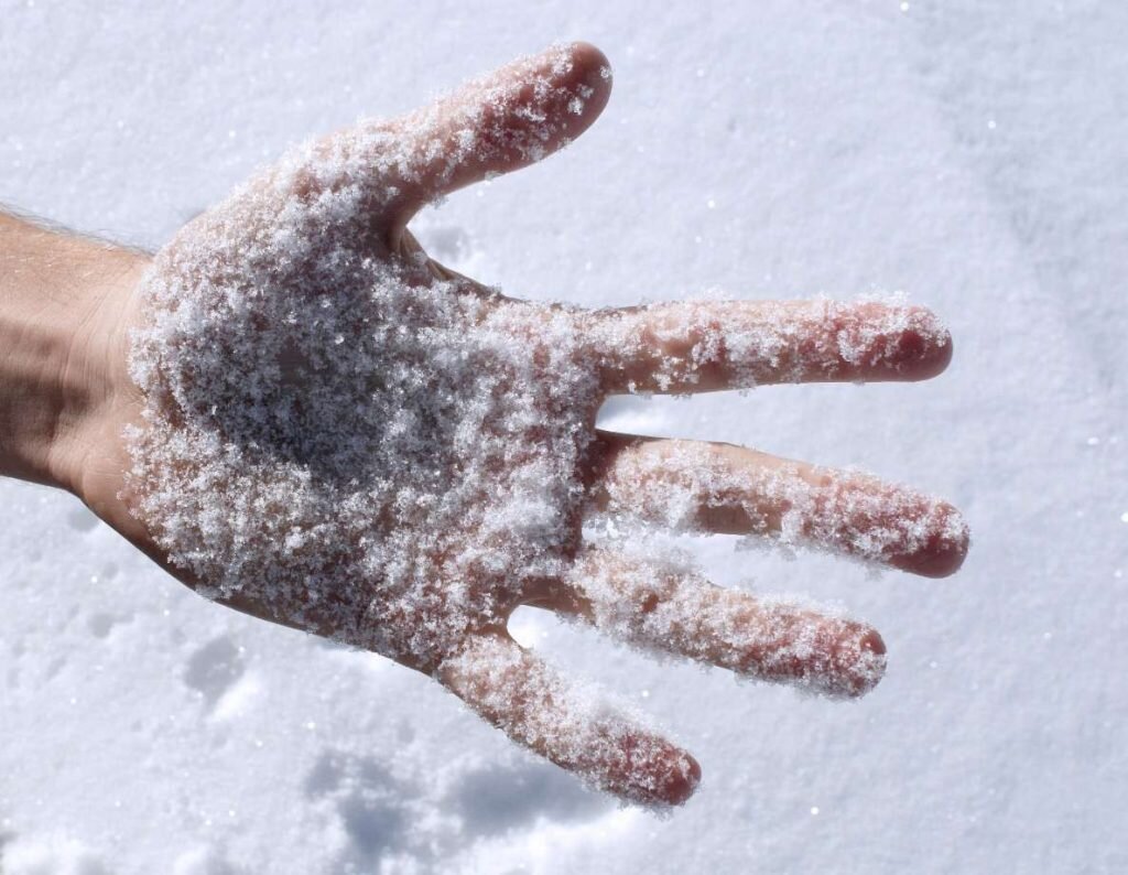 ЕСЛИ ТРЕСКАЕТСЯ КОЖА НА РУКАХ - Как спасти руки от мороза