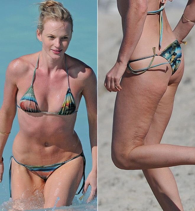 Фигура "скинни фэт"