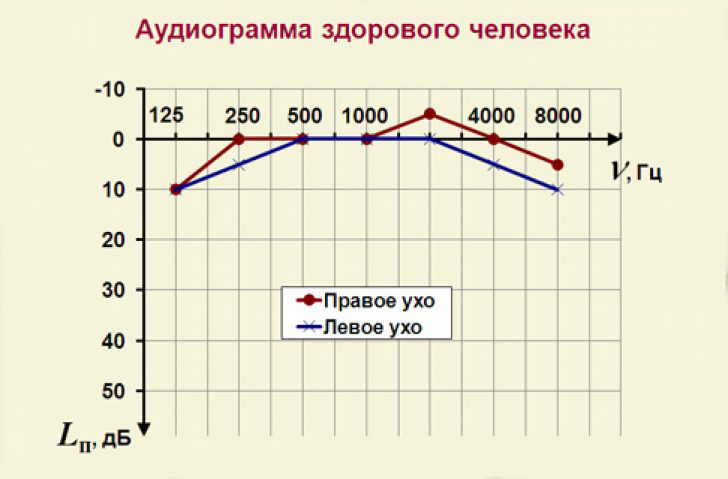 Аудиограмма здорового человека