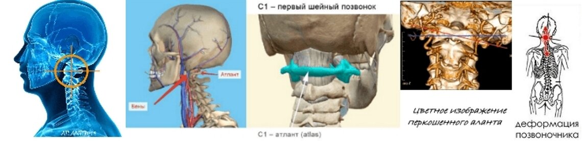 Оздоровительный центр Шадского в Чите