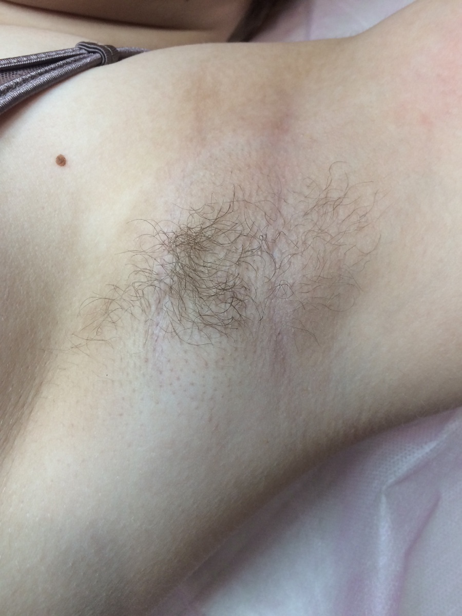 До (девочке 12 лет)