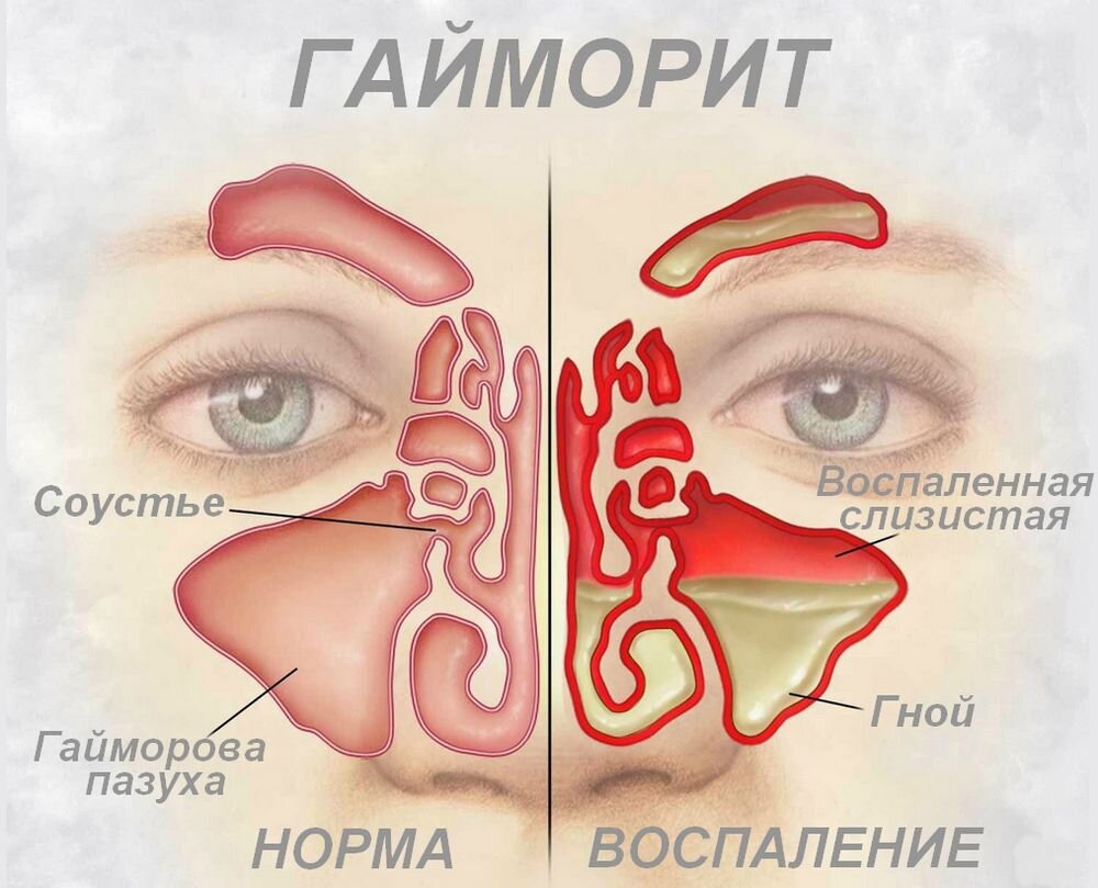 яндекс.картинки