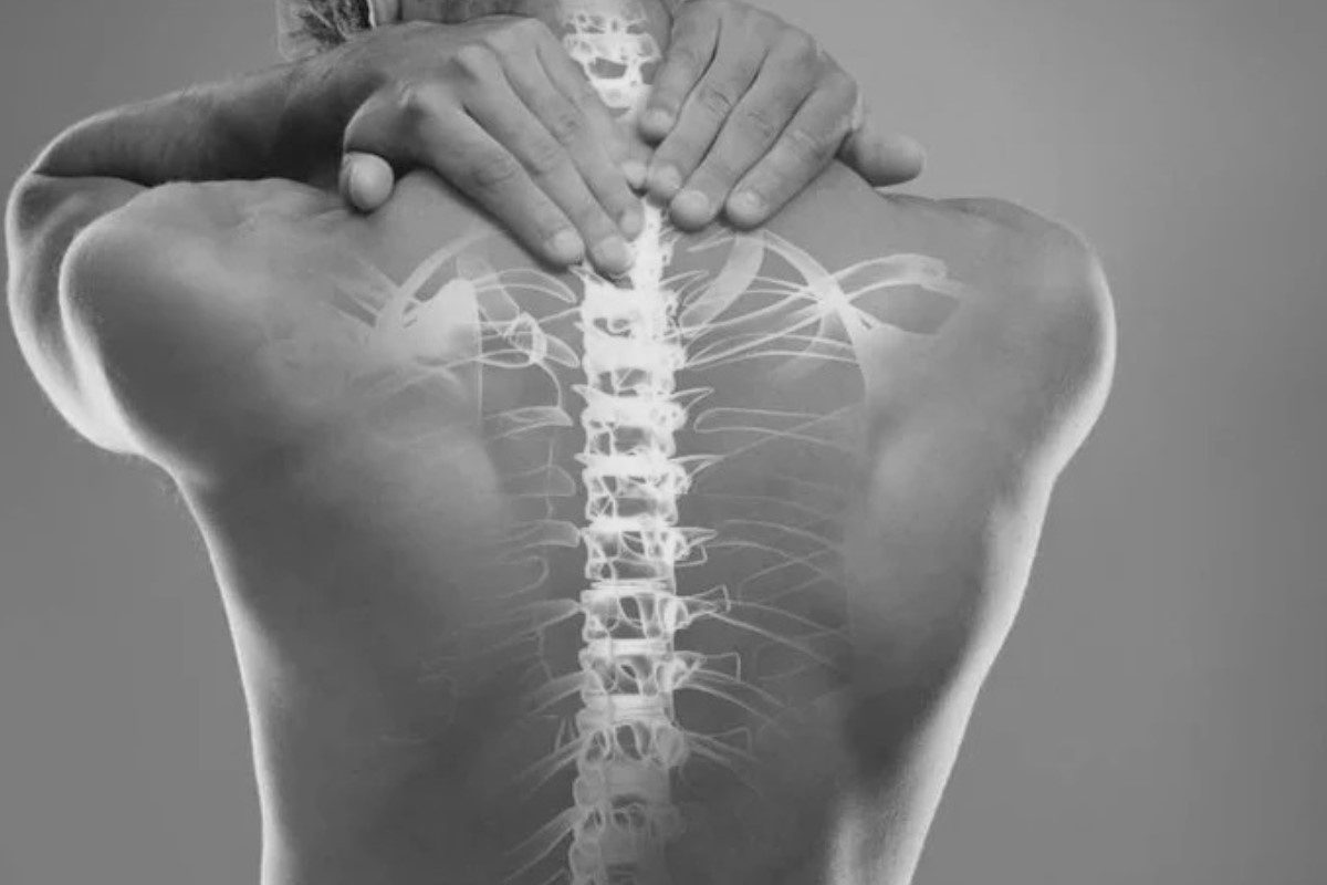 Остеохондроз. Болезнь позвоночника. 