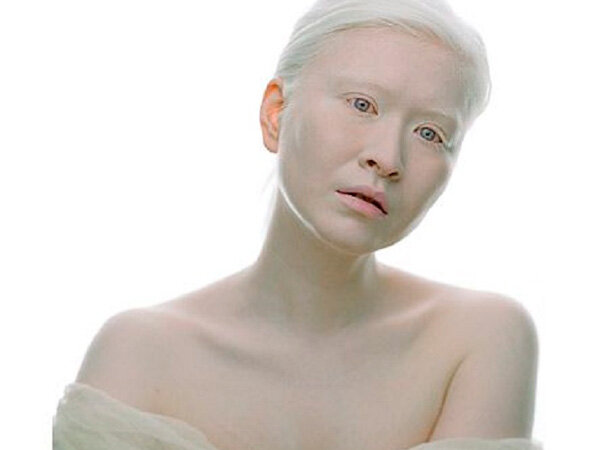 Альбиносы люди фото без фотошопа