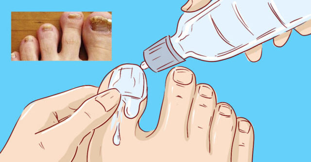 Почему чернеют ноги и пальцы на ногах при сахарном диабете и как это лечить?
