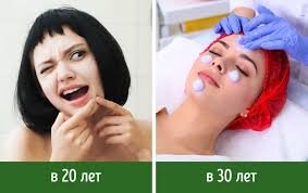 Фото из сети Google