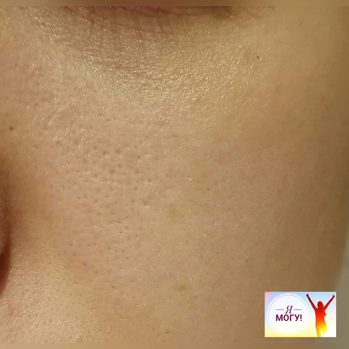 Личное фото автора канала "Я Могу!". В самом начале применения обсуждаемого средства. P.S. Пардон за освещение,делала фото в спешке, не думала, что настолько будет удачный опыт, чтобы о нем писать статью