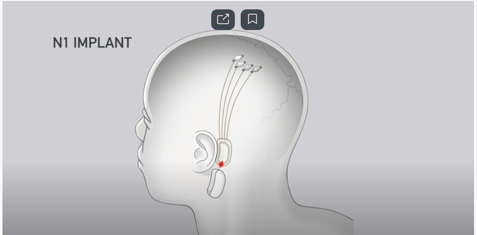 Презентация Neuralink 