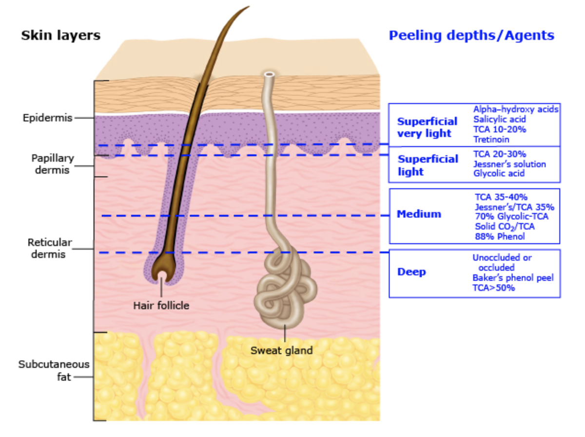 Источник изображения: UpToDate. Картинка подсказывает, какие пилинги рекомендованы при пигментации разного уровня залегания: поверхностная (гликолевые и салициловые пилинги 20%, ТСА), средняя/дермальная (ТСА 20-30%, пилинг Джесснера, гликолевый пилинг 70%), глубокая (ТСА >50%, феноловый пилинг). 