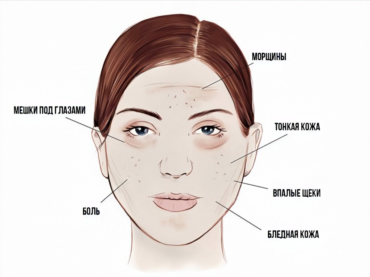 признаки налицо. микроинсульт симптомы у мужчин последствия. признаки юридического диц. юр лицо признак устав. признаки юридическогомлтца.