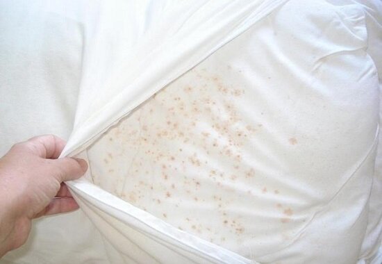 Так выглядит подушка, которую срочно надо стирать! 