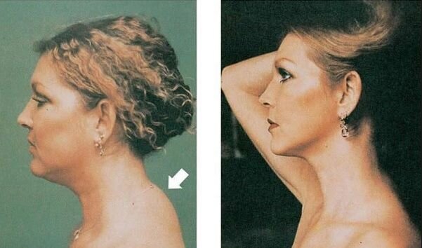 Источник фото: pinterest.com