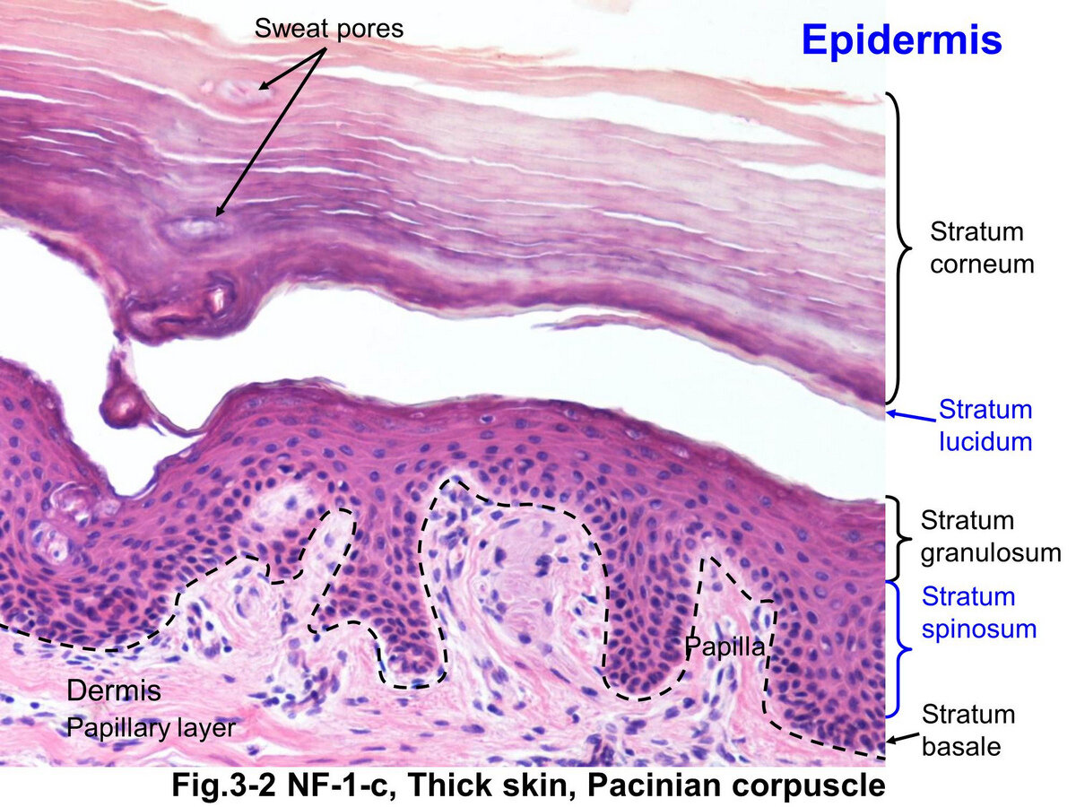 Thick skinned. Stratum lucidum слой кожи. Stratum spinosum of epidermis. Stratum corneum. Stratum spinosum слой.