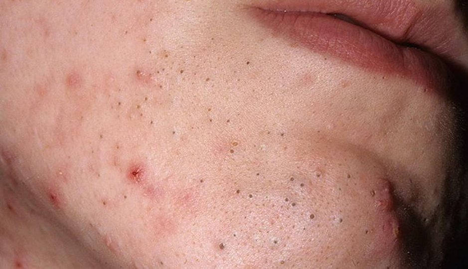 Тут уже череные точки