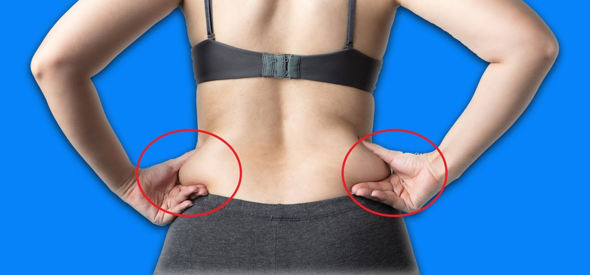 Жир на пояснице у женщин. Жирный живот и бока. Лишний жир. Неправильное похудение. Спасательный круг вокруг живота.