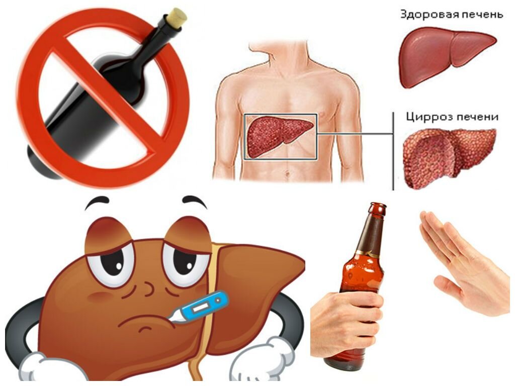 АЛКОГОЛЬНАЯ БОЛЕЗНЬ ПЕЧЕНИ | ##Медицина для всех## | Дзен