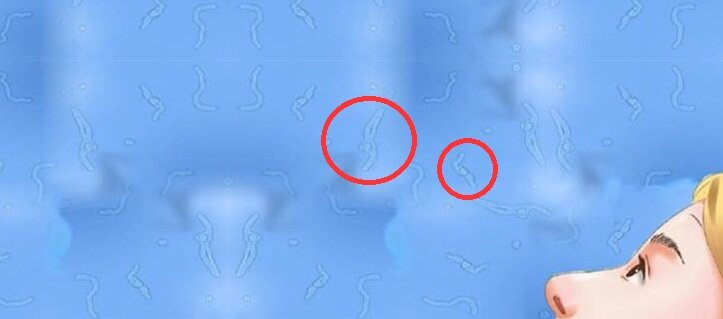 Muscaevolitantes или стекловидные помутнения - научное название этого явления.