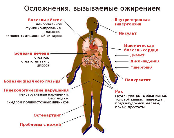 Опасности ожирения