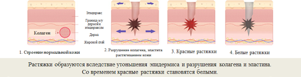 Есть ли у вас такие проблемы? Пишите в комментариях как боритесь с этим вы!