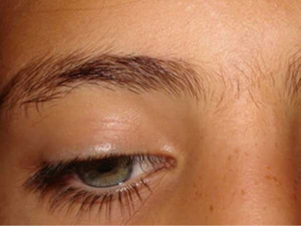 До шугаринга