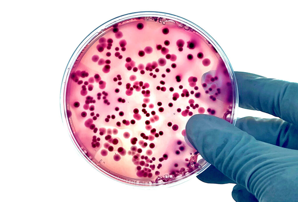 Иллюстрация: news.asante.org 