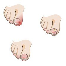 (orthos-прямой, onyx-ноготь)