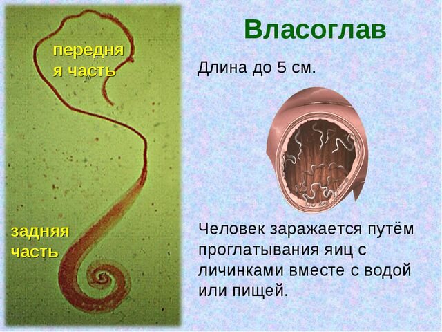 Соленая вода убивает глистов