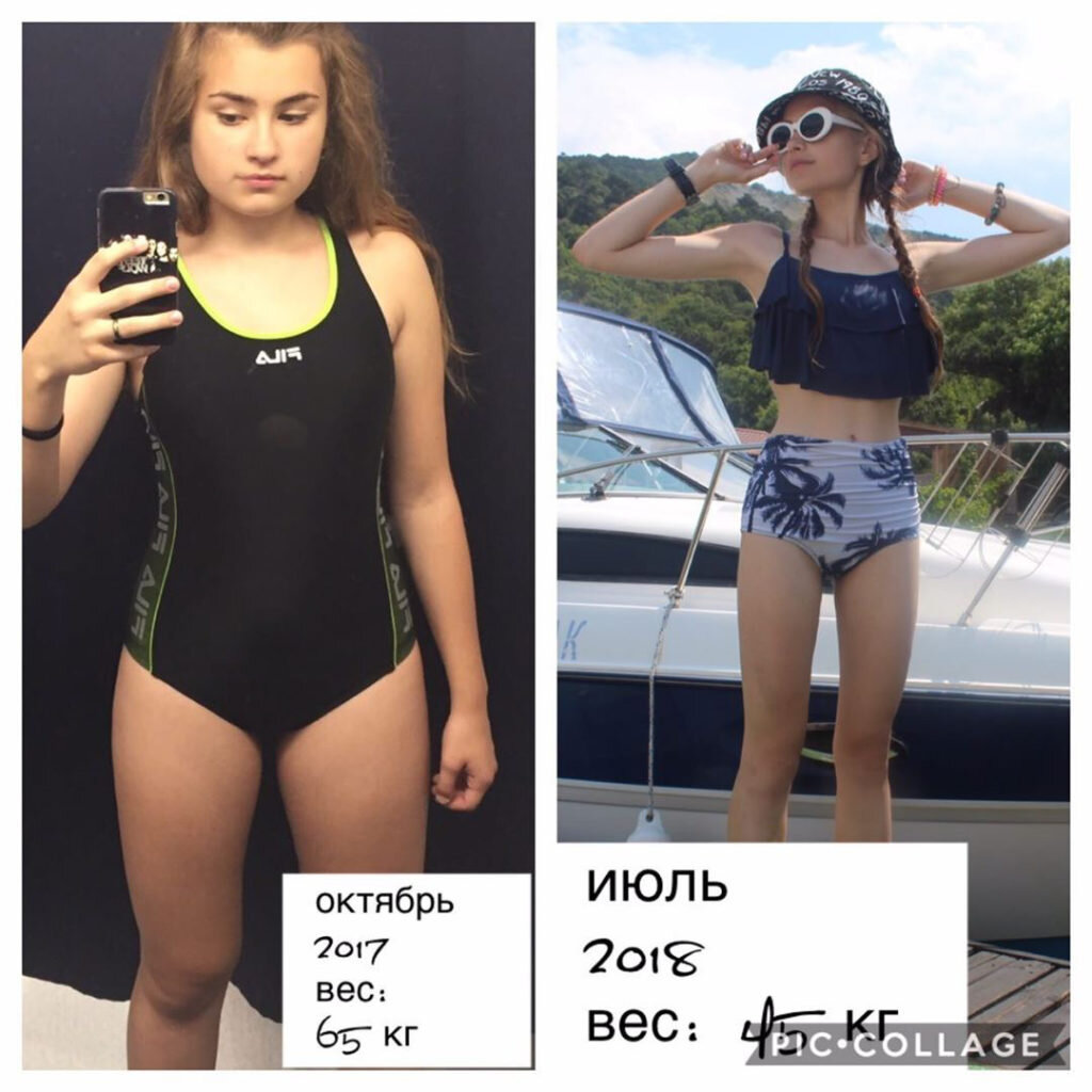 Похудение на оземпике до и после