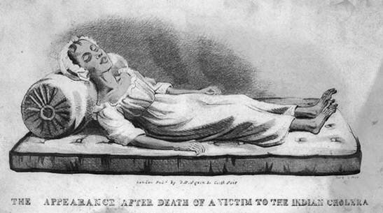 Больной холерой