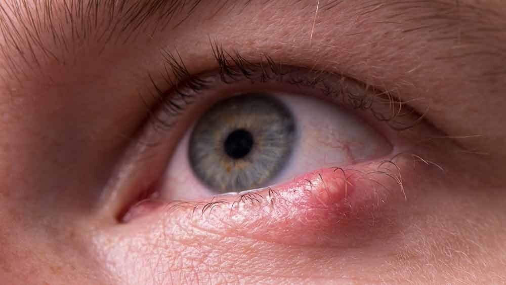 Справочник глазных болезней