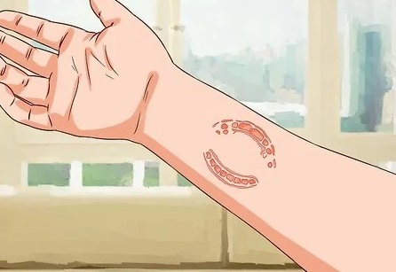 укус человека.