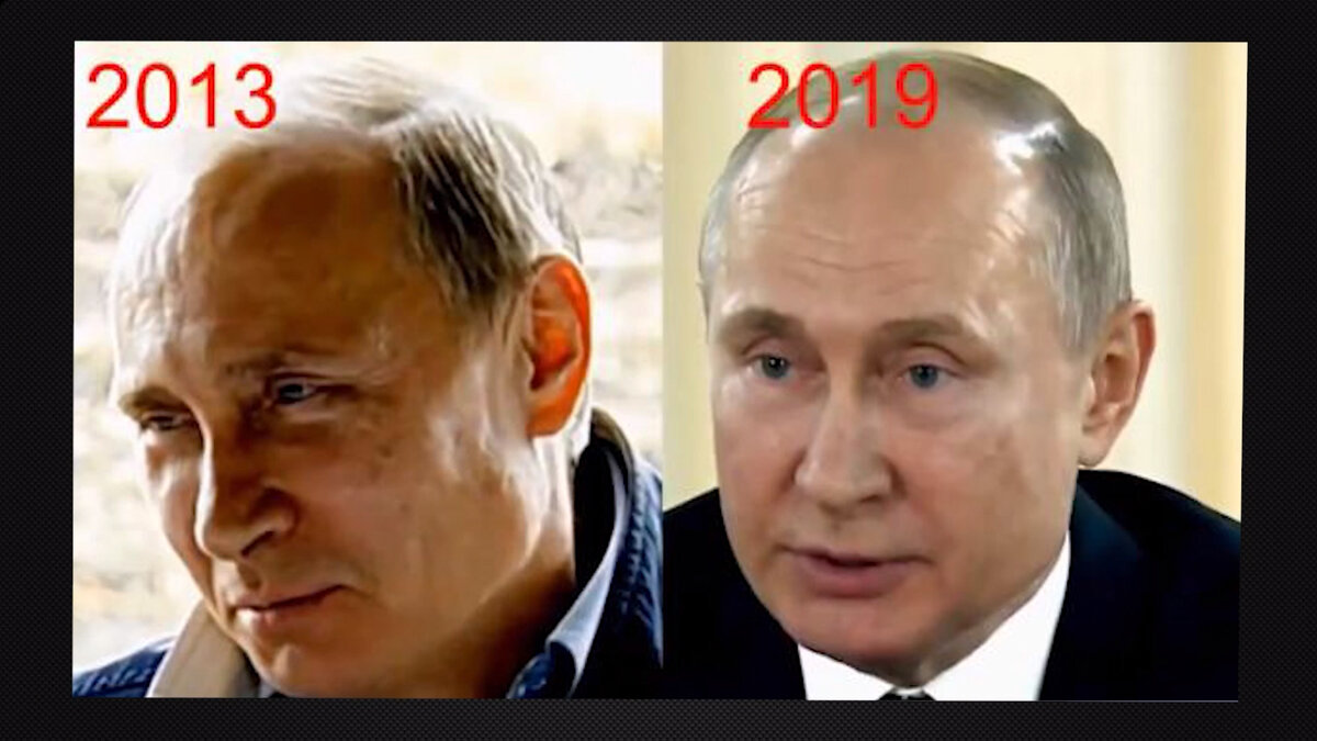 Пластические операции путина до и после фото
