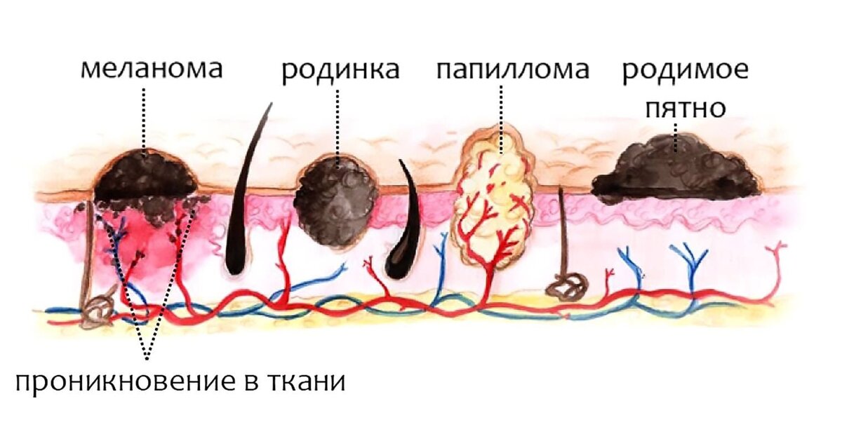 Иллюстрация взята с сайта яндекс Картинки