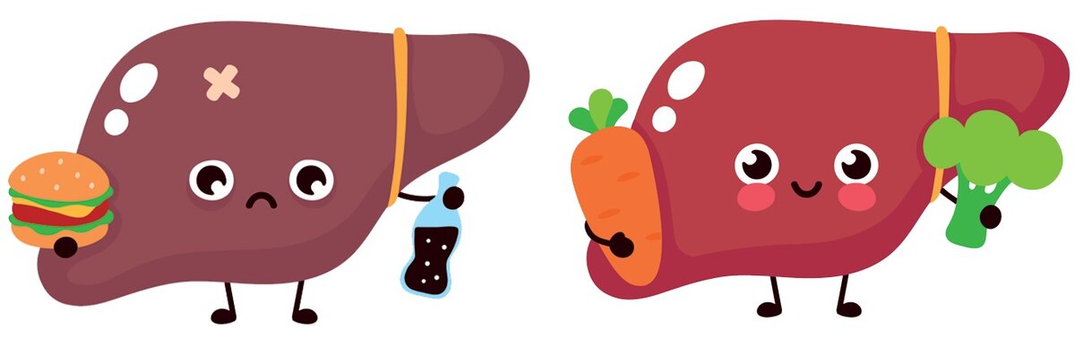 Жирная печень у стройных людей. Как так? | Ликбез от врача Ищенко А.Ю ...