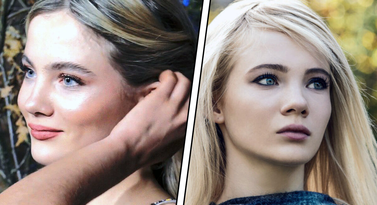 Фрея аллан до и после пластики