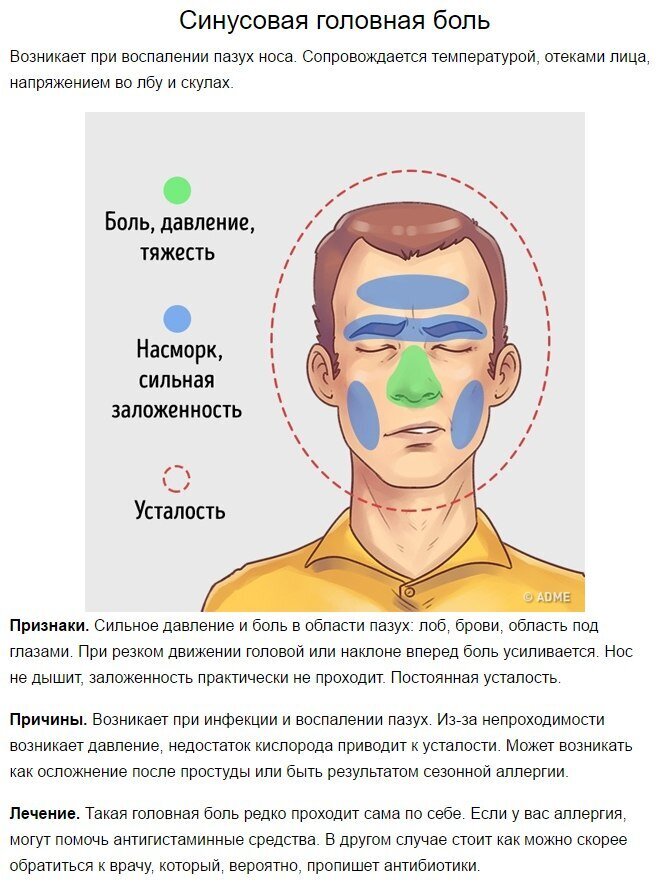 Лечить головную. Типы головной боли. Болит голова. Головная боль в области. Сильная головная боль.