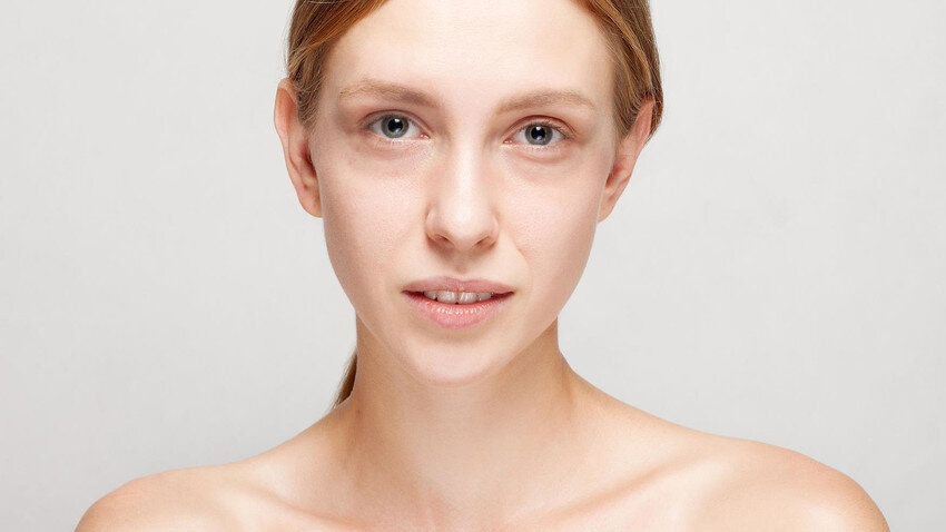 Мешки под глазами и отеки вокруг глаз