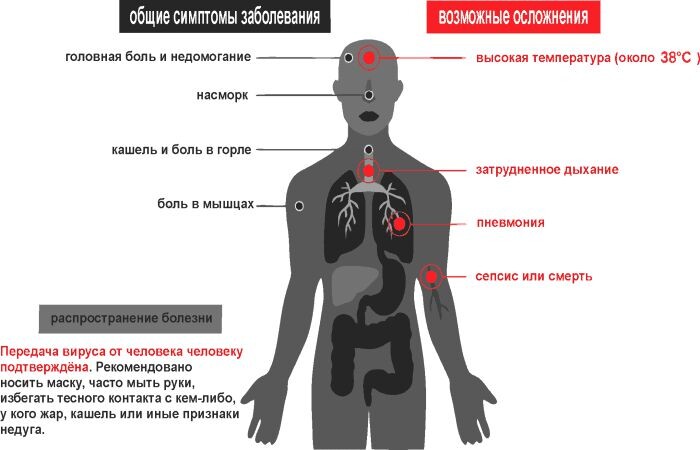 Симптомы заболеваний короновирусом 
