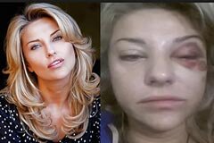 Избитая Маратом бывшая жена