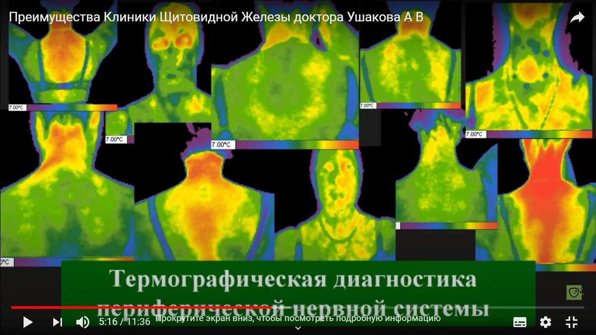 Кадр из фильма о преимуществах Клиники