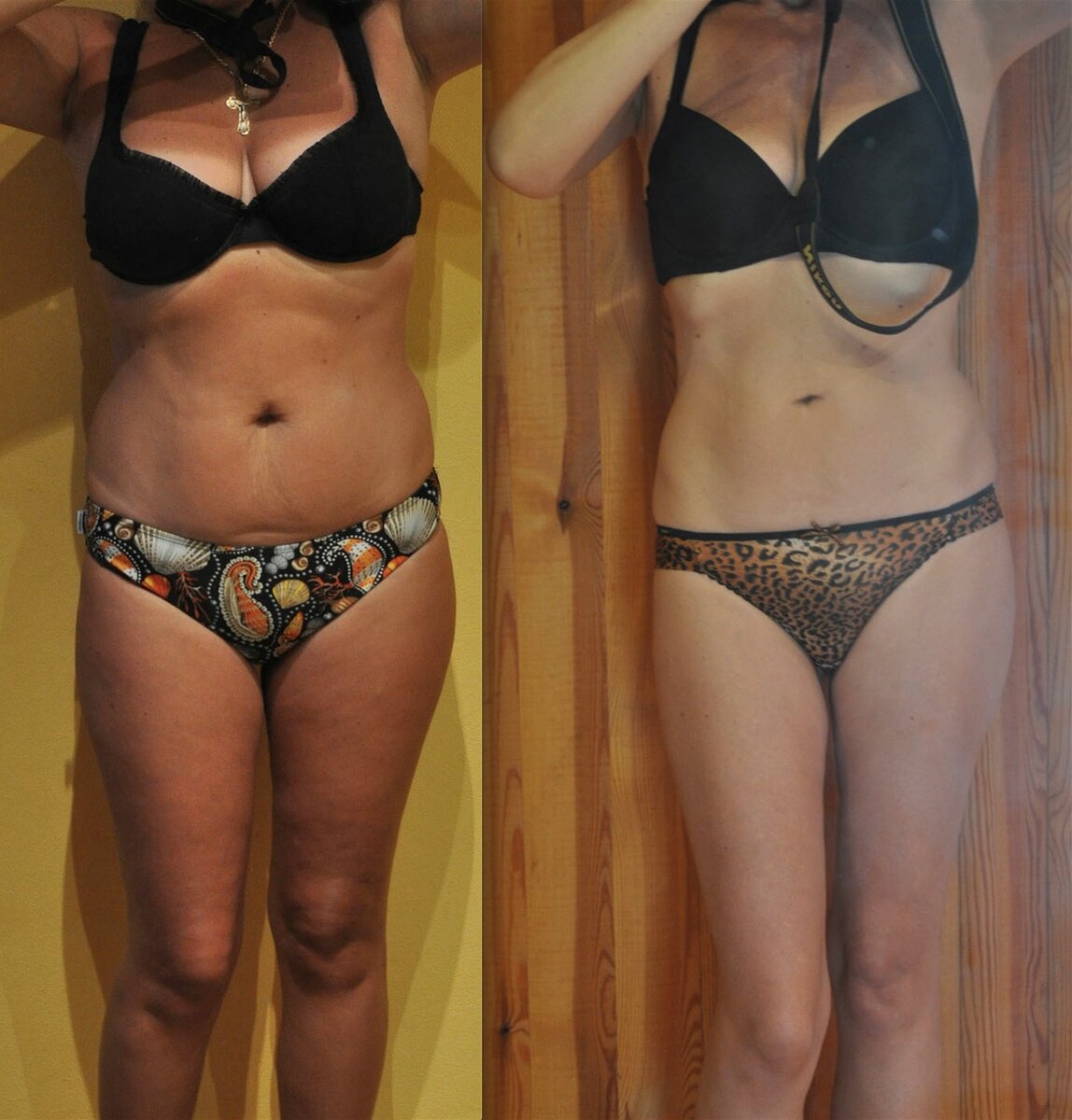 Похудеть с бодифлекс. Калланетика до и после. Занятия бодифлексом до и после. Корпан до похудения. Бодифлекс до и после.