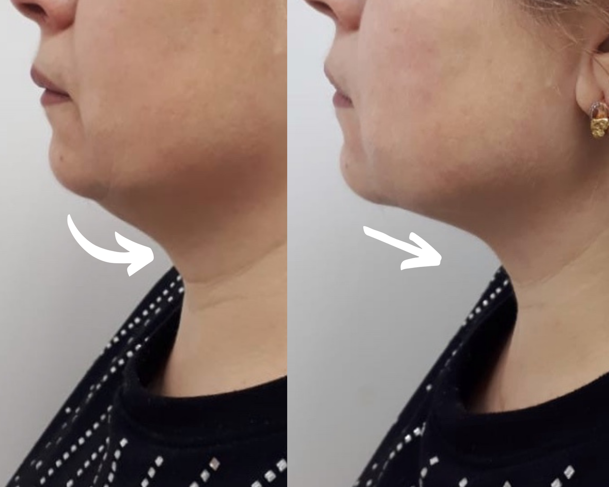 Клиника эстетической медицины и косметологии FaceLifting Москва