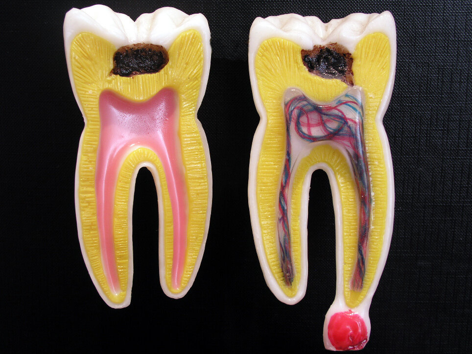 Интересные и занимательные факты из истории стоматологии
