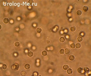 Микроскопическое исследование мазка на флору