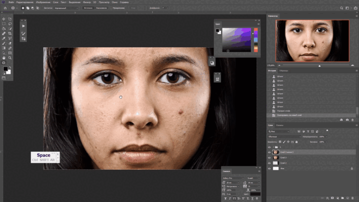 Удаление прыщей через "Заплатку"