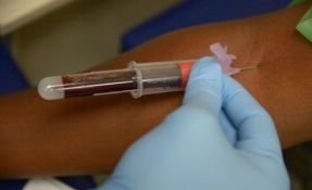 Анализ микробной ДНК в пробе крови помогает диагностировать рак. © База ВВС МакДилл